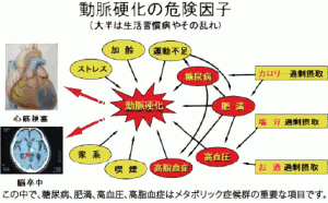 動脈効果の危険因子